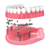 Dentures illustration